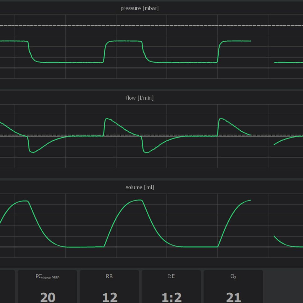 Banner-all-ventilation-modes-available