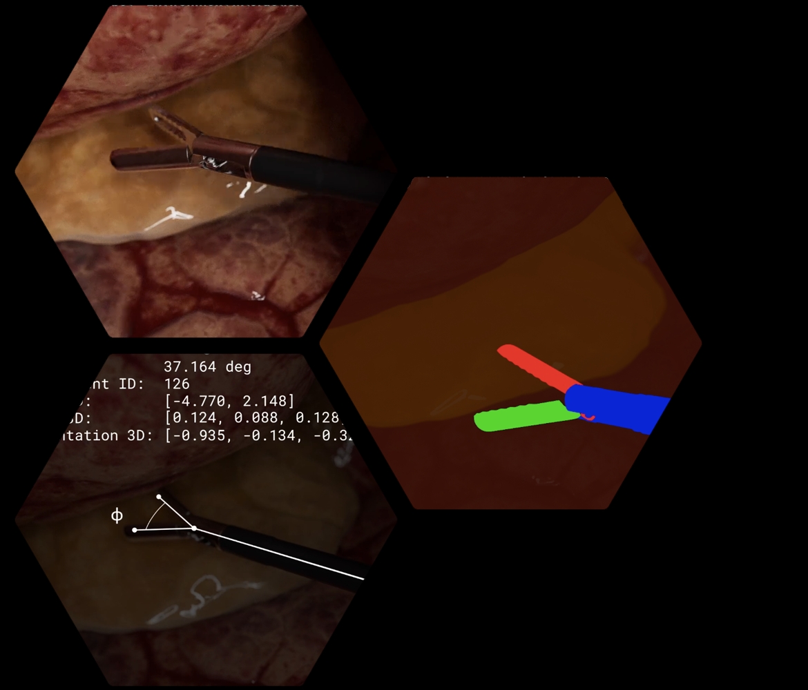 synthetic-data-for-surgical-tooling