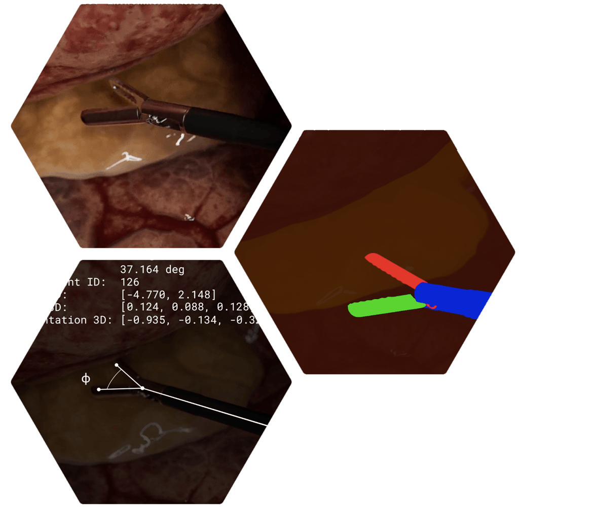 synthetic-data-for-surgical-tooling